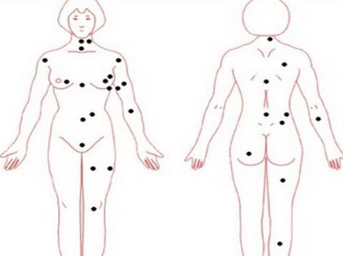 痣的位置与命运图女人身上的